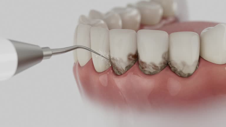 Trusted Teeth Cleaning And Checkup service in Waterford, CA - Dentist Open Now
